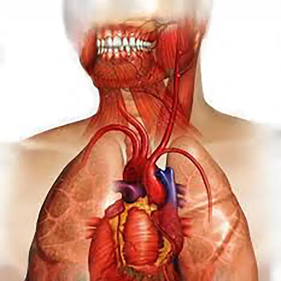 Enfermedades sistemicas por periodoncia