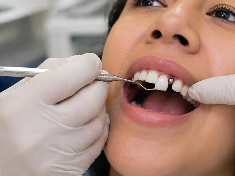 Implantes Dentales en Ambato