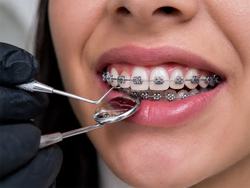 Ortodoncia en Ambato 1