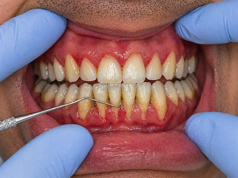 Periodoncista en ambato