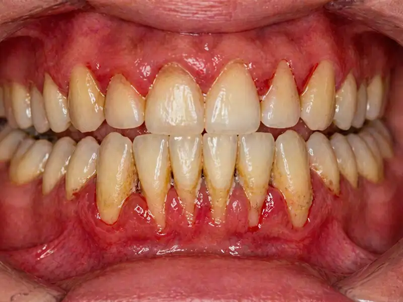 Periodoncista en ambato